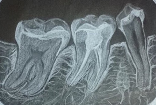 Cabecera-endodoncia-recortada