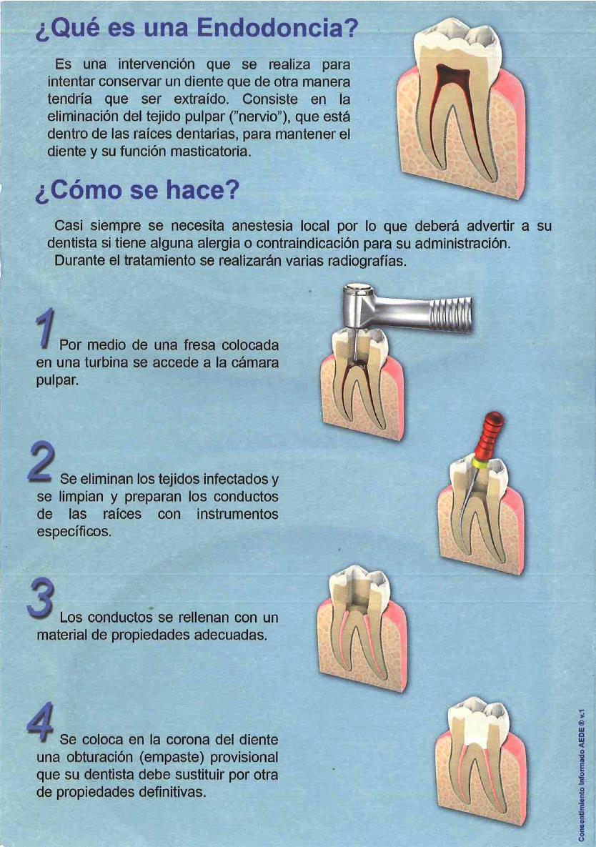 Triptico-endodoncia